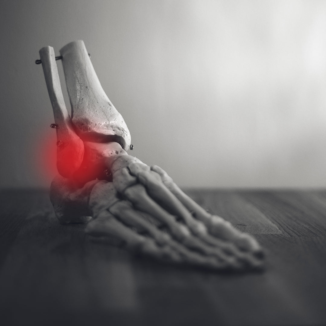 Tips And Stretches For Treating A Rolled Ankle