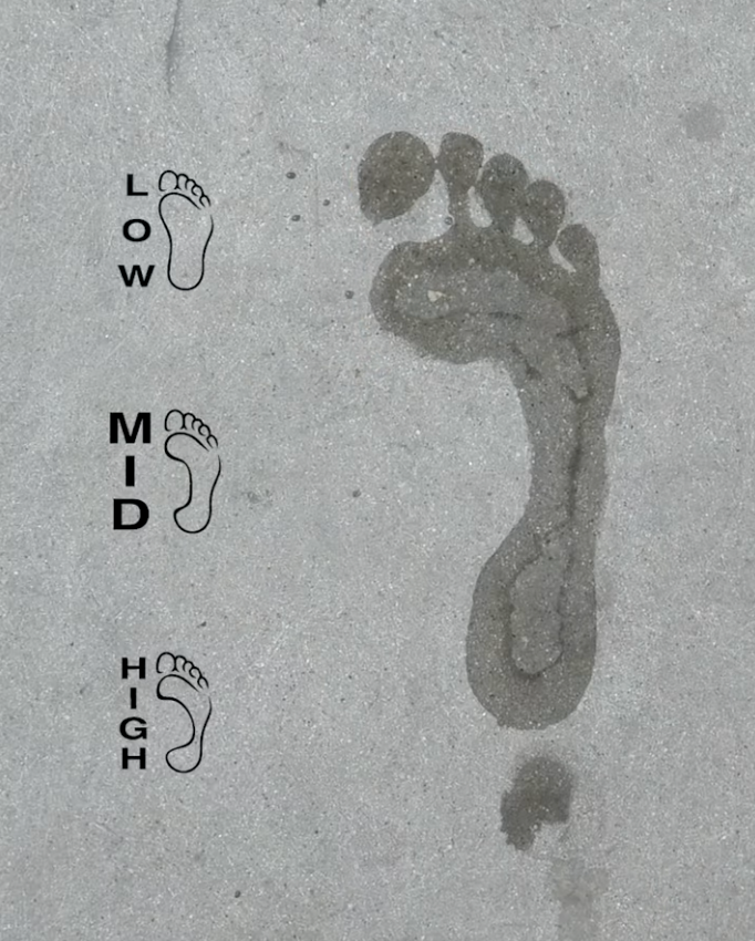 Flat Feet or High Arches? Here’s How to Pick the Best Remind Insoles